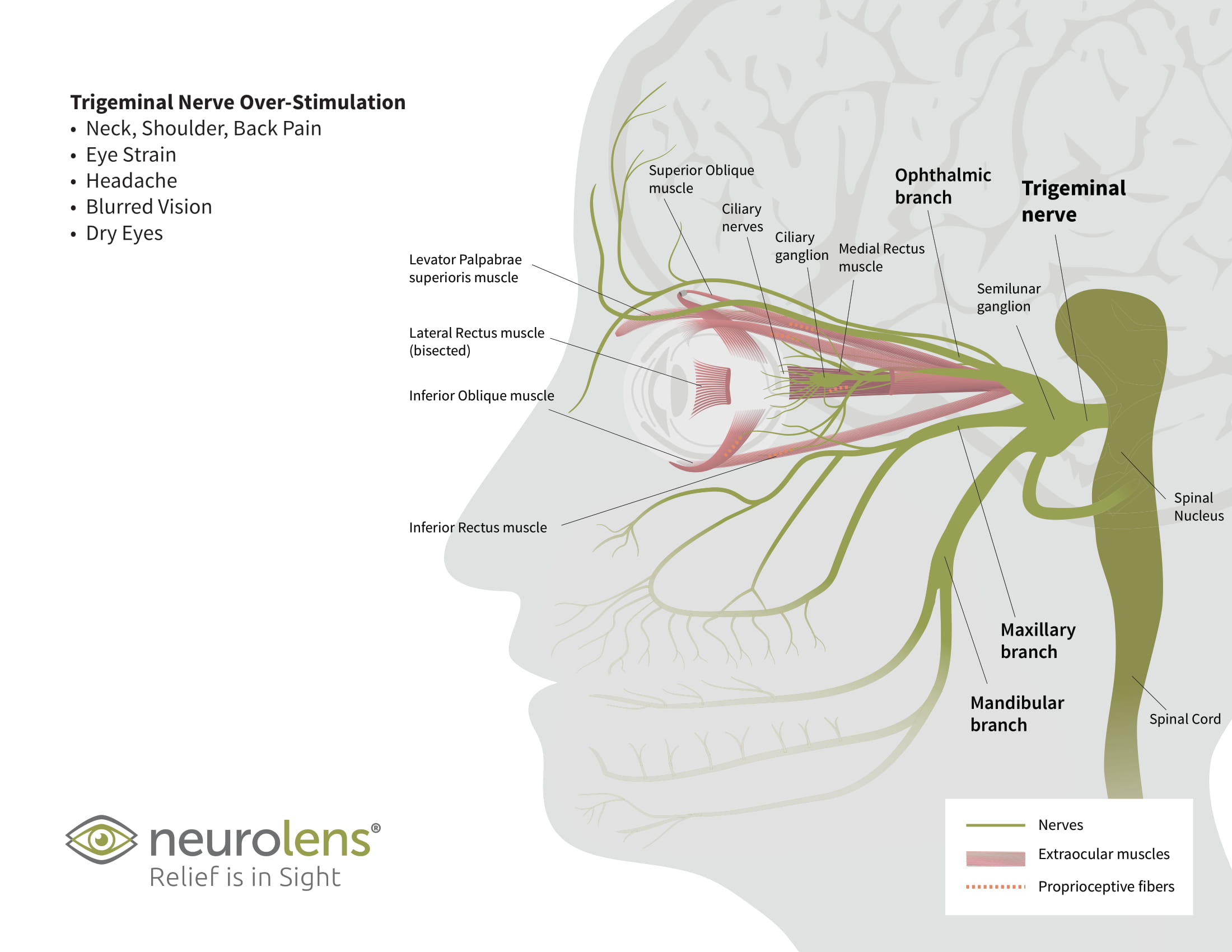 Peripheral Nerve Stimulation Newport Beach, CA