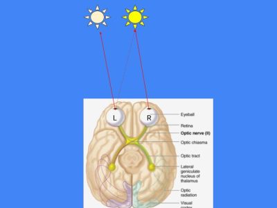 Eyesight Problem Diagram