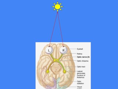 Vision Diagram